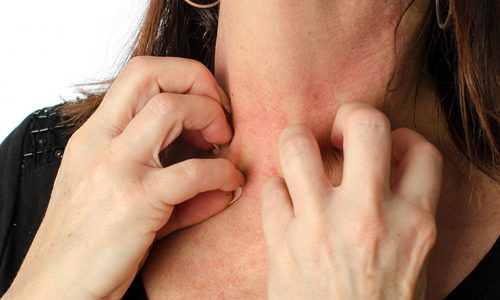 Woman scratching her neck Woman scratching her neck, isolated on white